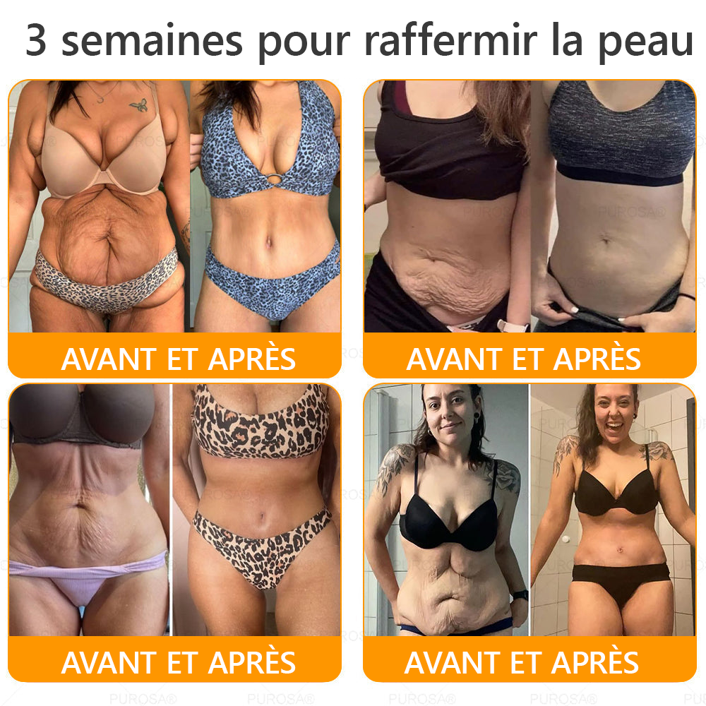 🐝PUROSA® Venin d'abeille  Crème de restauration de la peau🔥 DERNIÈRE JOURNÉE – 80 % DE RABAIS !