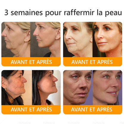 🐝PUROSA® Venin d'abeille  Crème de restauration de la peau🔥 DERNIÈRE JOURNÉE – 80 % DE RABAIS !