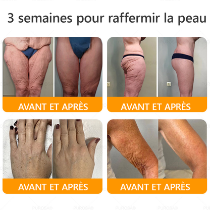🐝PUROSA® Venin d'abeille  Crème de restauration de la peau🔥 DERNIÈRE JOURNÉE – 80 % DE RABAIS !